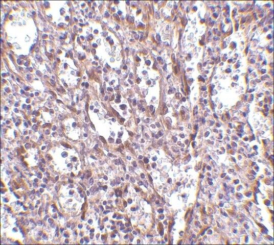 Anti-STIM1 antibody produced in rabbit