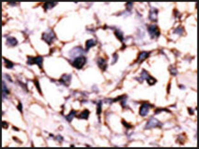 Anti-STK29 (center) antibody produced in rabbit