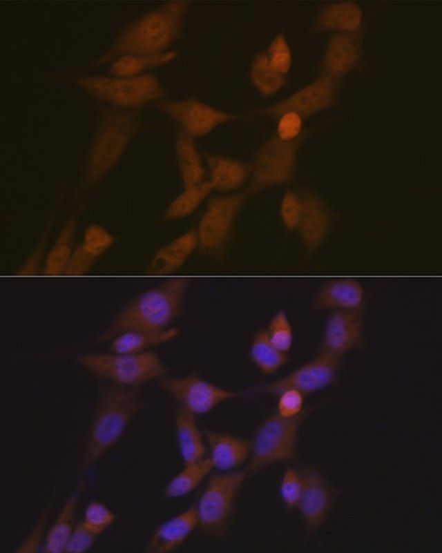 Anti-STK33 antibody produced in rabbit