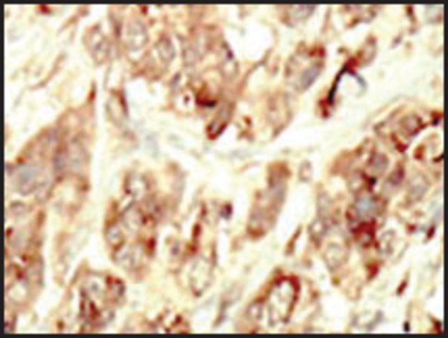 Anti-STK35 (center) antibody produced in rabbit