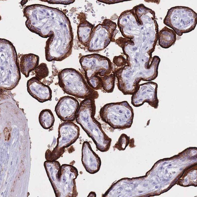 Anti-ST3GAL5 antibody produced in rabbit