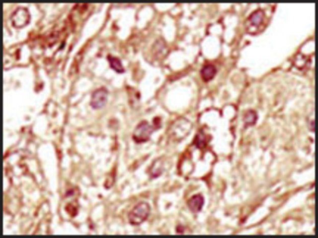 Anti-STK35 (N-term) antibody produced in rabbit
