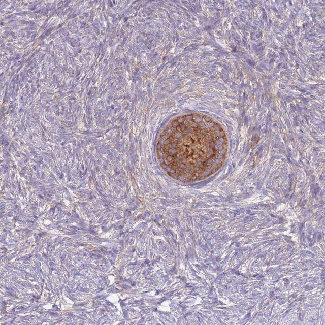 Anti-ST3GAL4 antibody produced in rabbit
