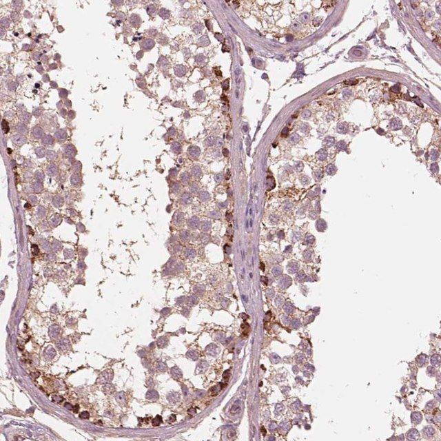 Anti-STK33 antibody produced in rabbit