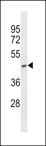 ANTI-ST6GALNAC5 (C-TERM) antibody produced in rabbit