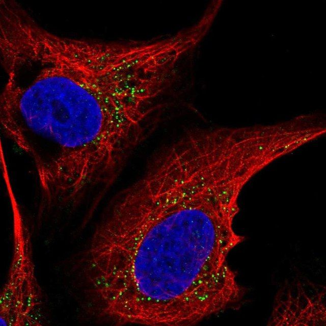Anti-ST6GALNAC5 antibody produced in rabbit