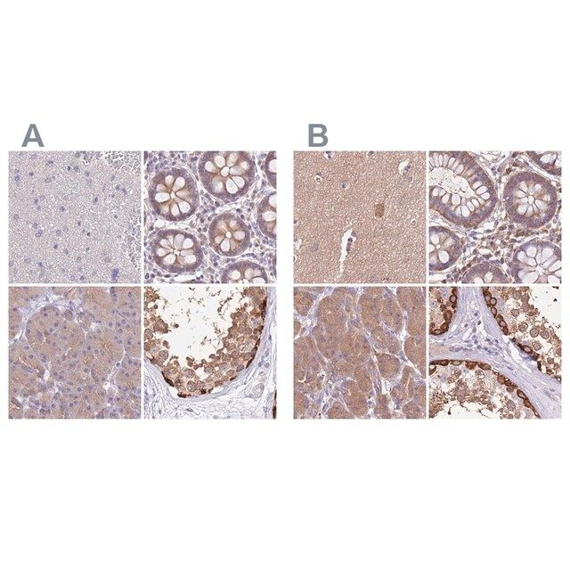 Anti-STIP1 antibody produced in rabbit