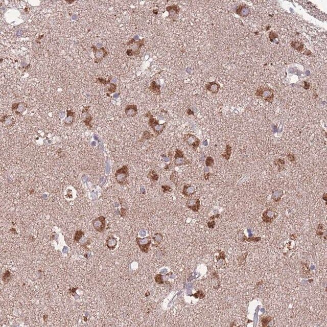 Anti-STIM2 antibody produced in rabbit