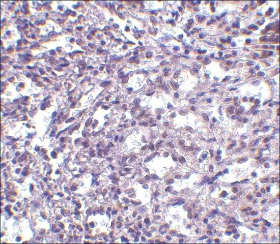 Anti-STIM2 (ab1) antibody produced in rabbit