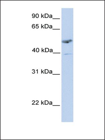 Anti-ST3GAL1 antibody produced in rabbit