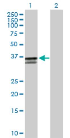 Anti-ST3GAL2 antibody produced in mouse