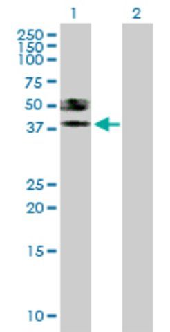 Anti-ST6GALNAC6 antibody produced in mouse