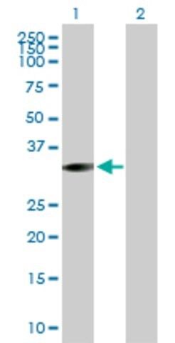 Anti-STK16 antibody produced in mouse