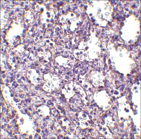 Anti-STIM2 (ab2) antibody produced in rabbit