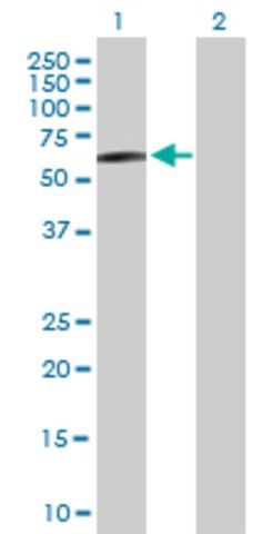 Anti-STK33 antibody produced in mouse