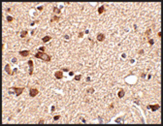 Anti-STK39 (ab2) antibody produced in rabbit