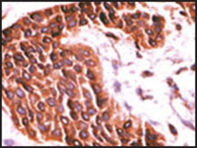 Anti-STK29 (C-term) antibody produced in rabbit