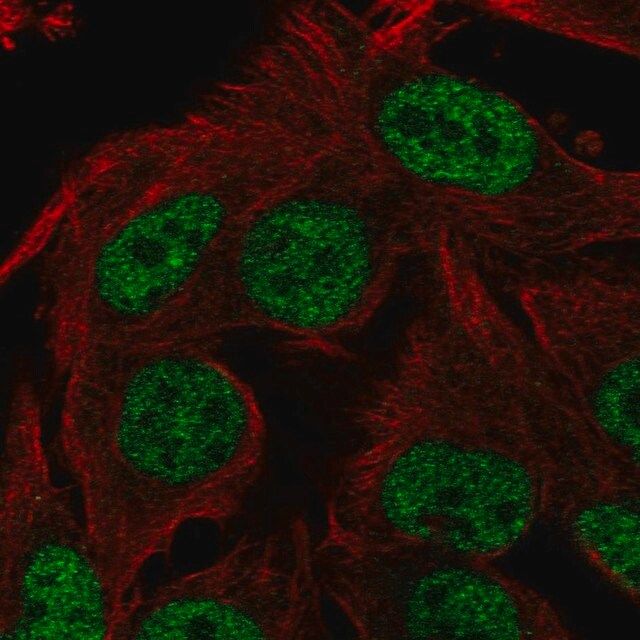 Anti-ST6GALNAC3 antibody produced in rabbit
