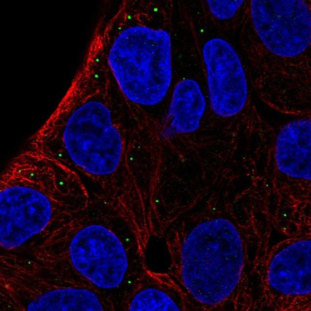 Anti-ST3GAL5 antibody produced in rabbit