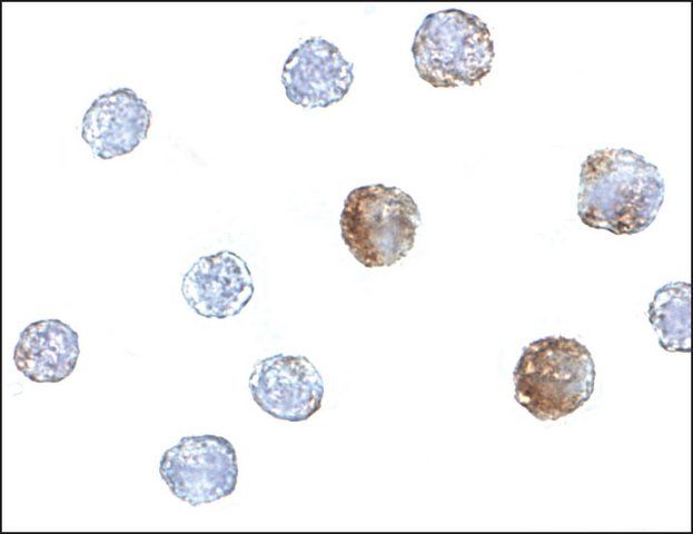Anti-ST3GAL6 antibody produced in rabbit