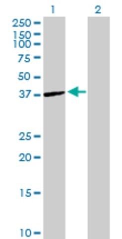Anti-ST6GALNAC6 antibody produced in mouse
