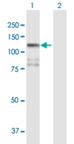 Anti-STK31 antibody produced in mouse