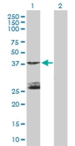 Anti-STK19 antibody produced in mouse