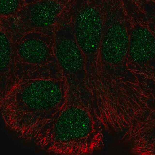 Anti-STK35 antibody produced in rabbit