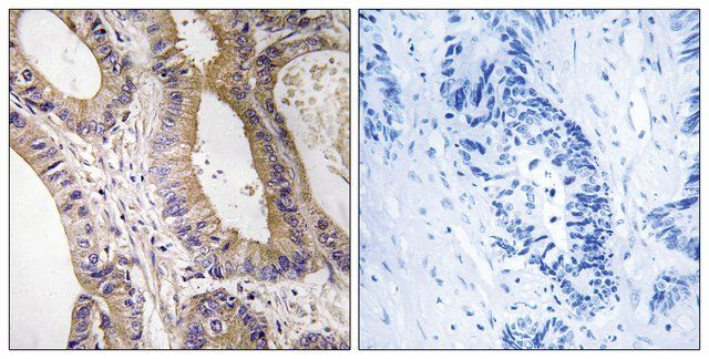 Anti-STK24 antibody produced in rabbit