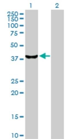 Anti-STK19 antibody produced in rabbit