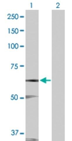 Anti-STK17A antibody produced in rabbit