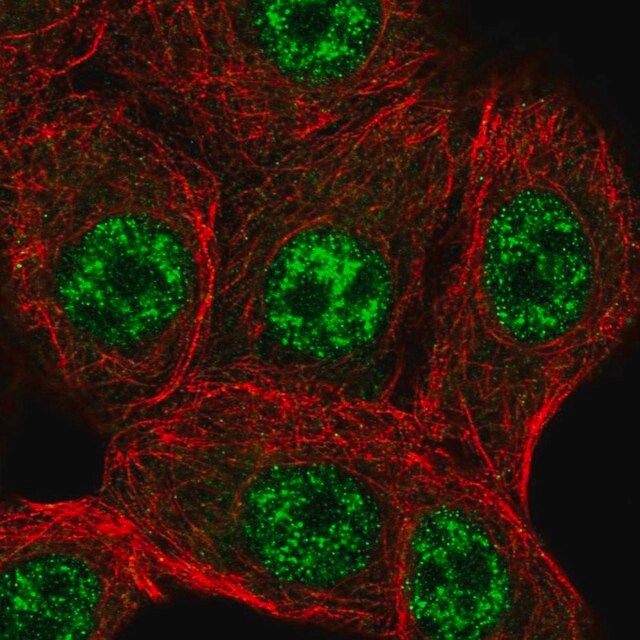 Anti-STK19 antibody produced in rabbit