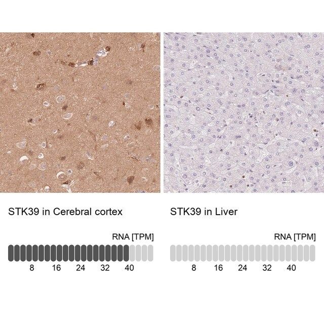 Anti-STK39 antibody produced in rabbit