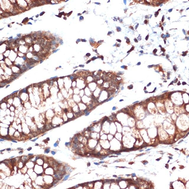 Anti-STK39 antibody produced in rabbit