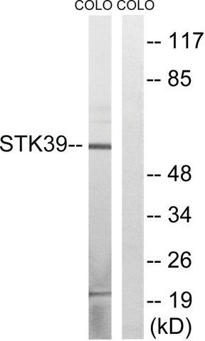 Anti-STK39 antibody produced in rabbit