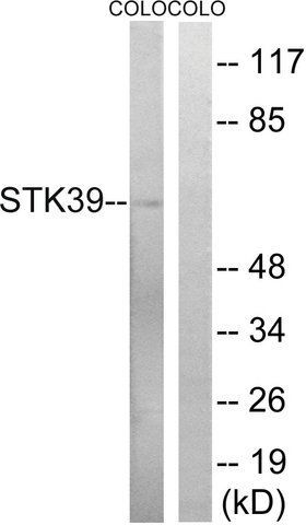 Anti-STK39 antibody produced in rabbit