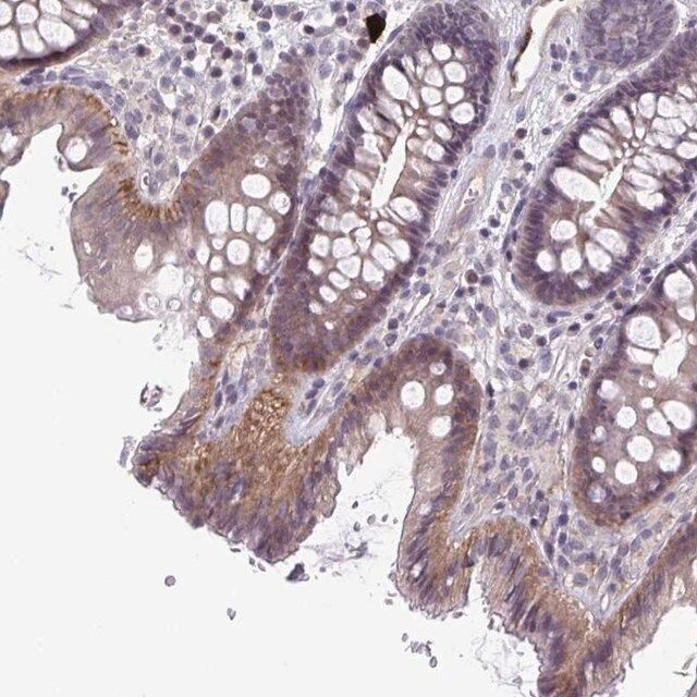 Anti-STK26 antibody produced in rabbit
