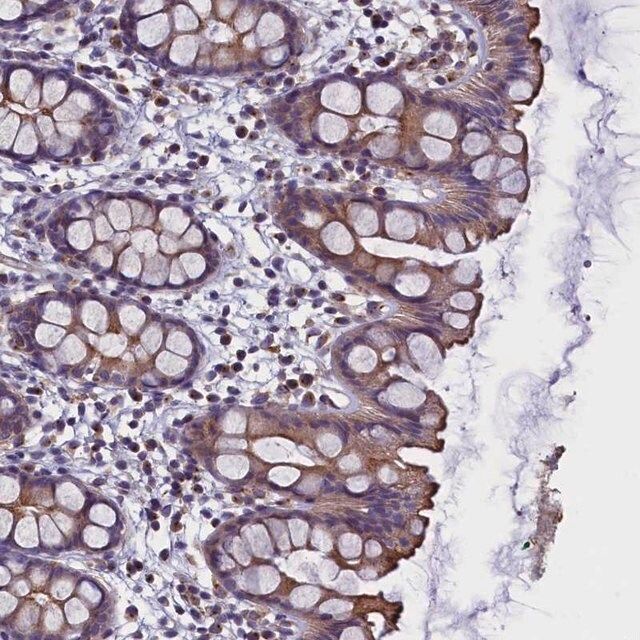Anti-STK32A antibody produced in rabbit