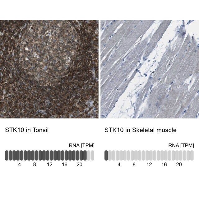 Anti-STK10 antibody produced in rabbit