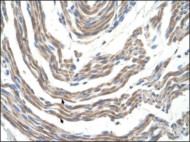 Anti-STK11 antibody produced in rabbit
