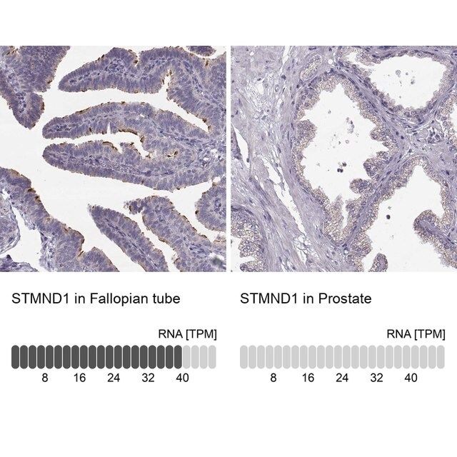 Anti-STMND1 antibody produced in rabbit