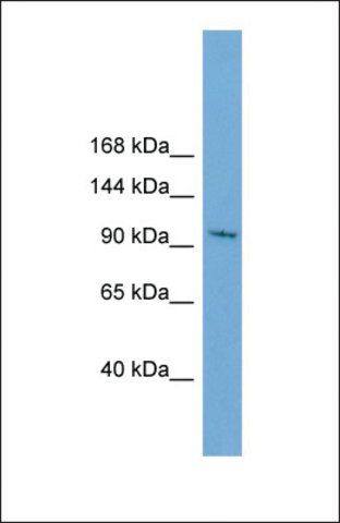 Anti-STK31, (N-terminal) antibody produced in rabbit