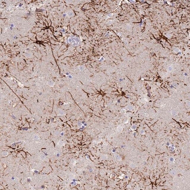 Anti-STK25 antibody produced in rabbit