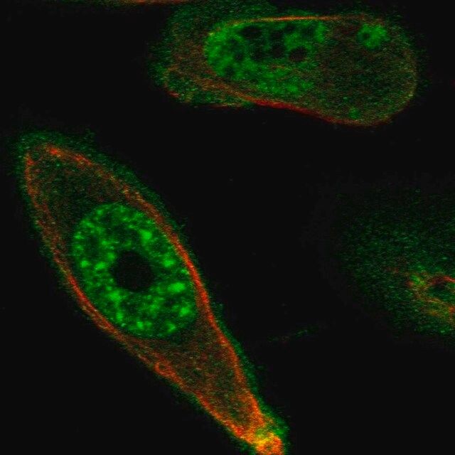 Anti-STK17A antibody produced in rabbit