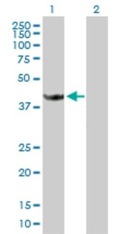Anti-STOML1 antibody produced in mouse