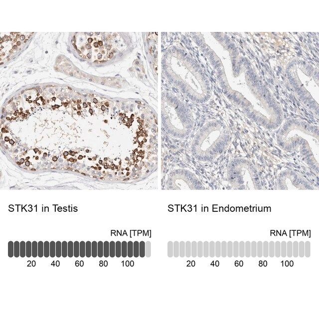 Anti-STK31 antibody produced in rabbit