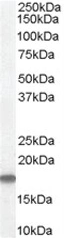 Anti-STMN1/STATHMIN 1 antibody produced in goat