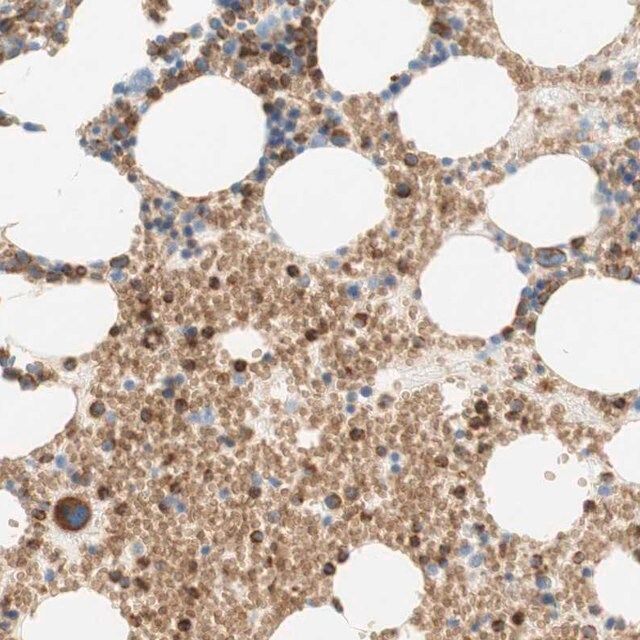 Anti-STOM antibody produced in rabbit