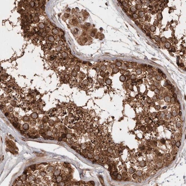 Anti-STK36 antibody produced in rabbit