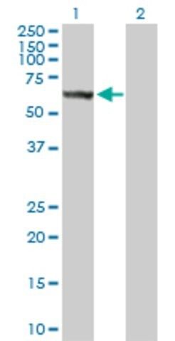 Anti-STK33 antibody produced in rabbit